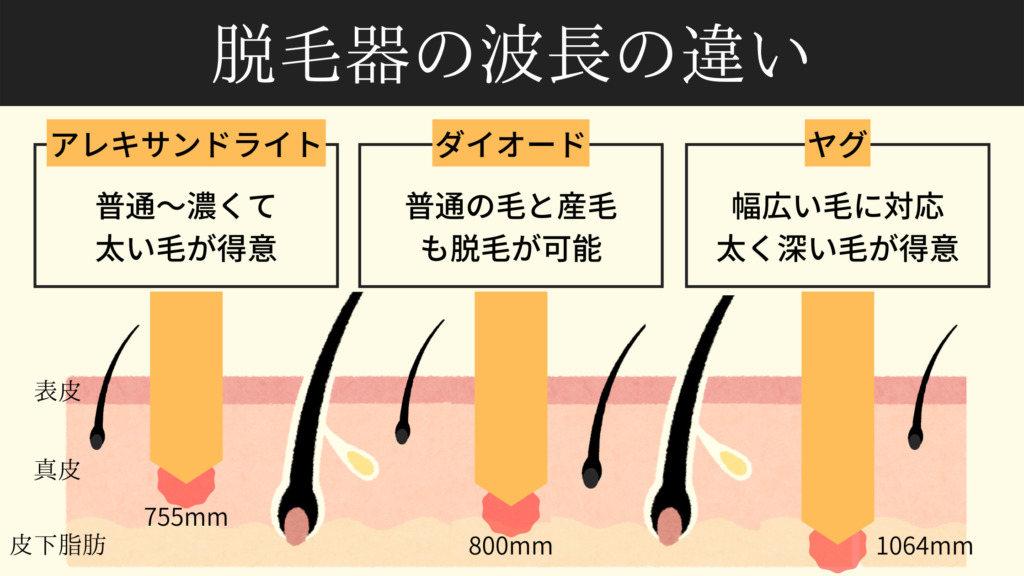 脱毛器のレーザーの種類や特徴の違い(アレキサンドライト、ダイオード、ヤグ)